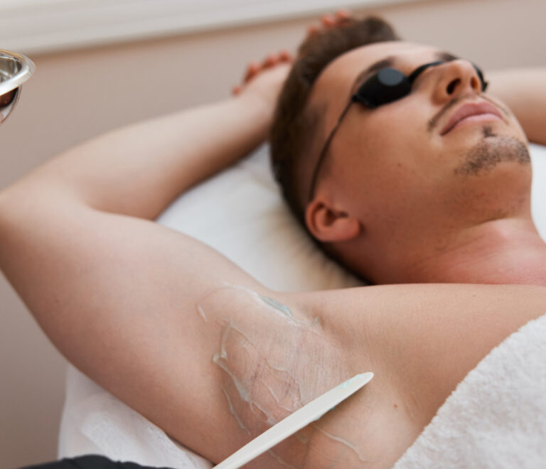 Epilations homme